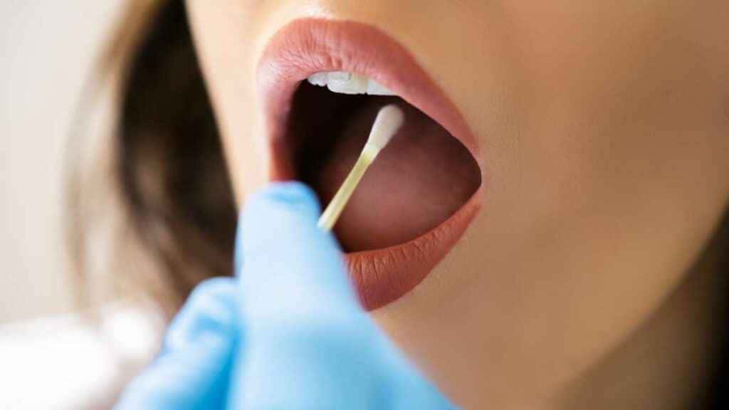 Doenças na boca: os perigos escondidos em sua cavidade bucal doenças na boca